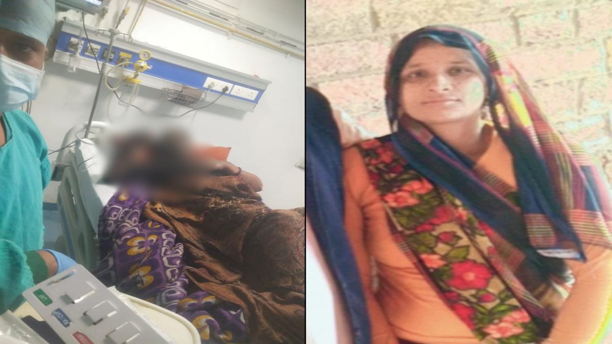 ससुरालियों का जुल्म : पहले बहू को पीटा, फिर डीजल छिड़ककर लगा दी आग, 90 प्रतिशत झुलसी