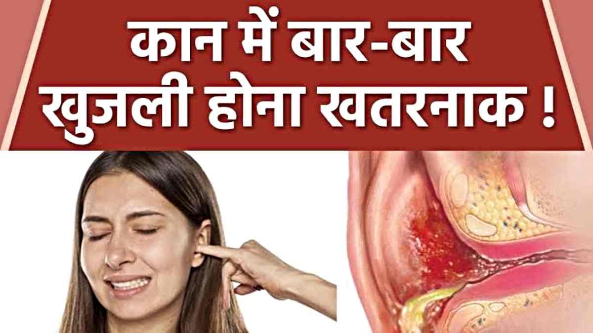 Ear Itching: आपको भी अक्सर रहती है कान में खुजली की समस्या, तुरंत डॉक्टर से करें संपर्क…