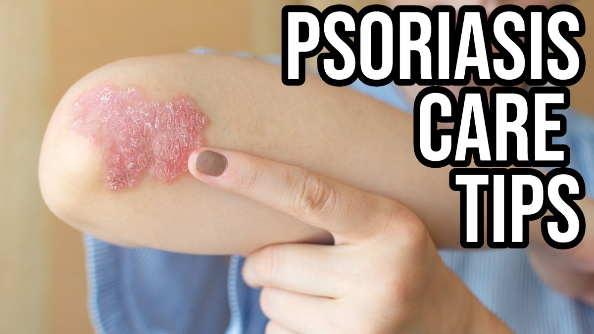 Psoriasis Care Tips: सर्दियों में सोरायसिस से बचाव के आसान उपाय, जानें कैसे रखें अपनी त्वचा स्वस्थ…