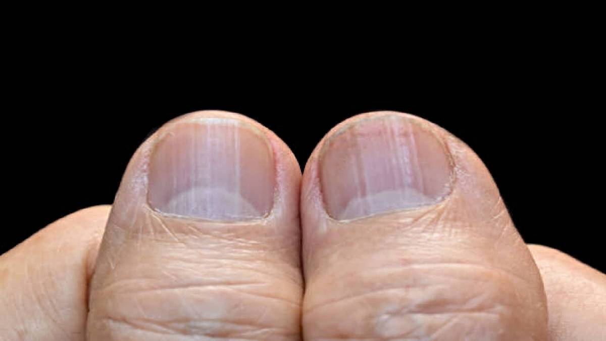 Palmistry Nails: नाखूनों पर बना अर्द्धचंद्र व्यक्ति को शुभ और अशुभ दोनों प्रकार के फल देता है, जाने किस तरह…