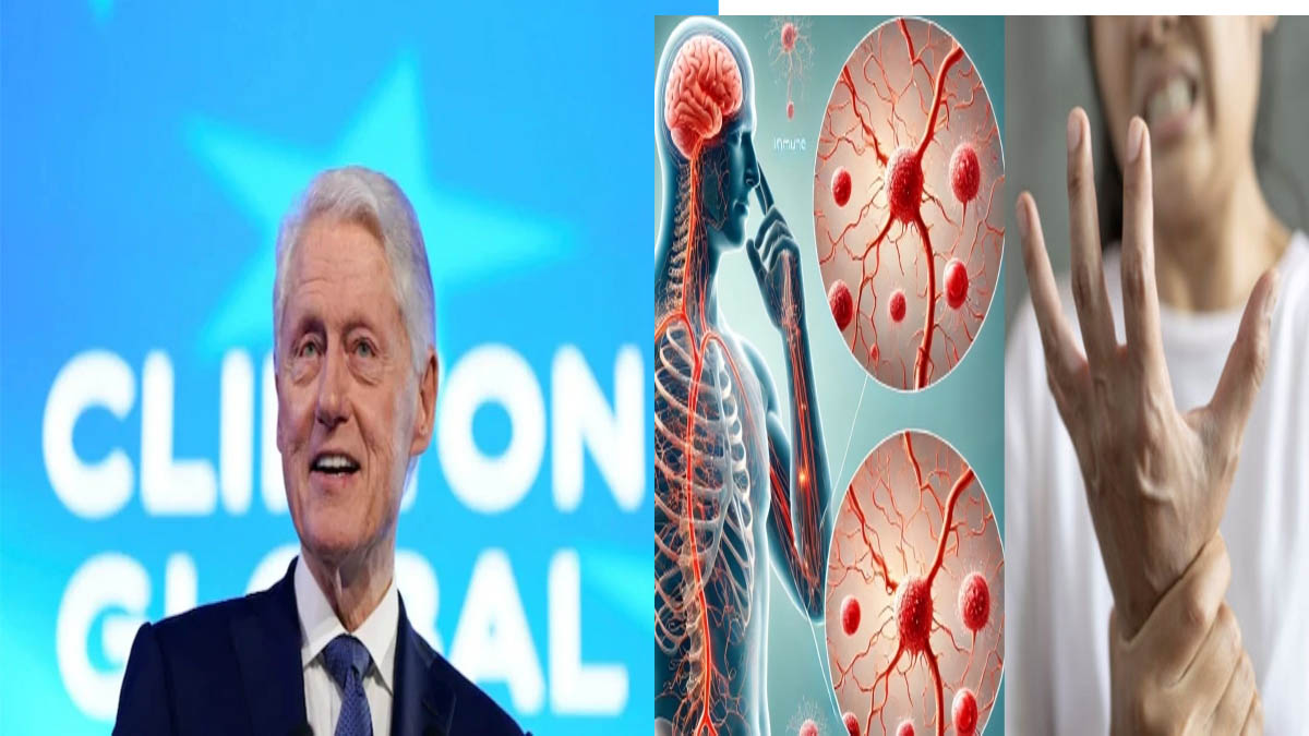 पुणे में फैली बीमारी का US कनेक्शन! अमेरिकी राष्ट्रपति रूजवेल्ट की GBS से हुई थी मौत