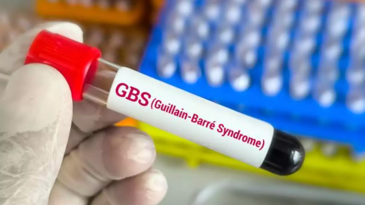 Guillain-Barre Syndrome: पुणे में गुइलेन-बैरी सिंड्रोम के 8 नए मामले ने बढ़ाई चिंता, कुल 67 मामले दर्ज, जानिए क्या है यह बीमारी और इसका बचाव