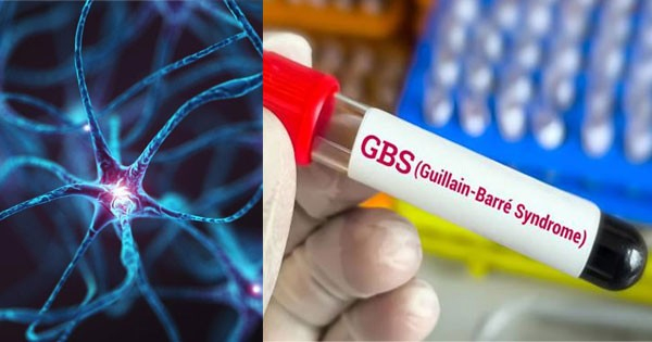 Guillain-Barre Syndrome: महाराष्ट्र में GBS का कहर! GBS से अब तक 2 की मौत, 127 एक्टिव केस, वेंटिलेटर पर 20 मरीज
