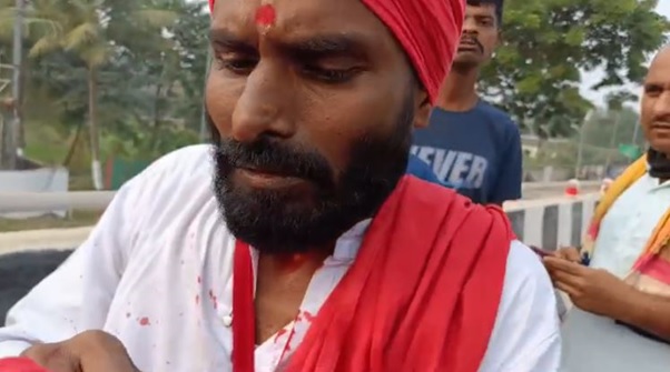 चाइनीज मांझे का कहर, बाइक सवार 2 घायल, एक की नाक कटी, दूसरे का गला