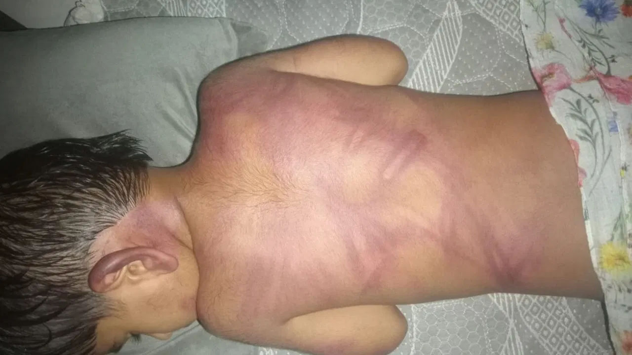 मां बनी हैवान! पति नहीं ले गया घुमाने तो 3 साल के बेटे  को बेरहमी से पीटा