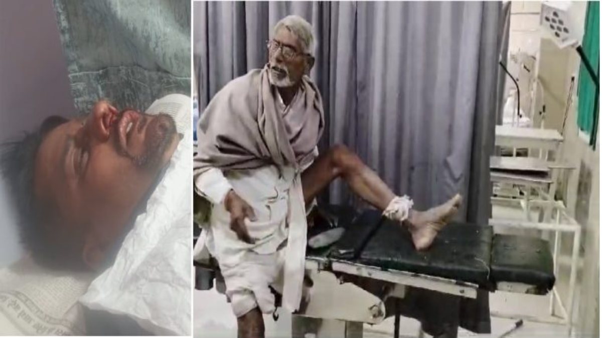 Chinese Manjha बना जी का जंजाल: बैतूल में चाइनीज मांझे से डॉक्टर की नाक कटी, लगे 10 टांके, शाजापुर में बुजुर्ग का पैर कटा