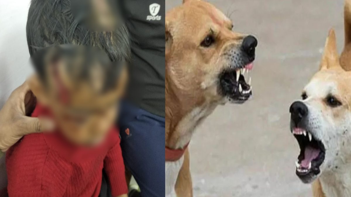 मासूम पर आवारा कुत्ते का जानलेवा हमला: बीच सड़क 15 मिनिट तक बच्चे को नोचता रहा कुत्ता, फिर ऐसे बची जान…