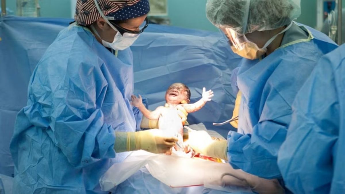 अमेरिका के अस्पताल में भारतीय महिलाओं की भीड़: समय से पहले करा रहे सीजेरियन डिलीवरी, Donald Trump के इस फैसले ने मचाई खलबली