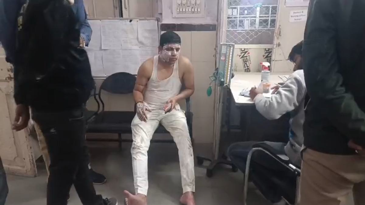 ठेले वाले ने कर दिया कांड: पार्षद पर डाला खौलता तेल, गंभीर रूप से झुलसे नेताजी