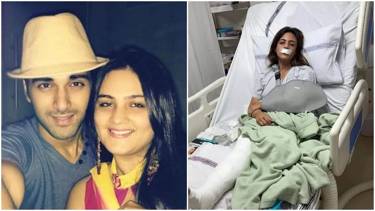 Pulkit Samrat की एक्स-वाइफ Shweta Rohira का हुआ भयानक एक्सीडेंट, फोटो शेयर कर एक्ट्रेस ने लिखा- चोट के निशान, टूटी हड्डियां …