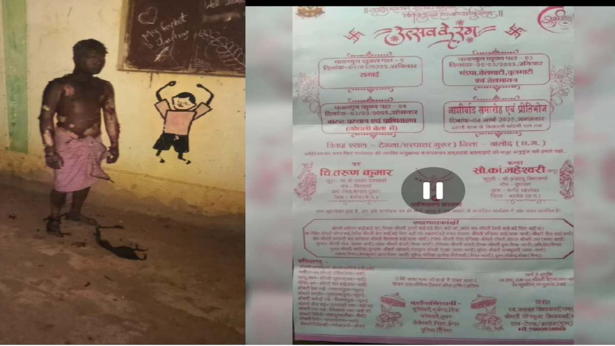 युवक ने खुद पर केरोसिन उड़ेलकर की आत्महत्या की कोशिश, हफ्तेभर बाद है शादी