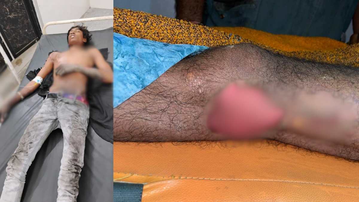 कोयला भरने के बाद वैगन में चढ़ा श्रमिक और रेलवे अधिकारियों ने चालू करवा दी बंद OHE, लगा 25kV का झटका, जिम्मेदार कौन ?