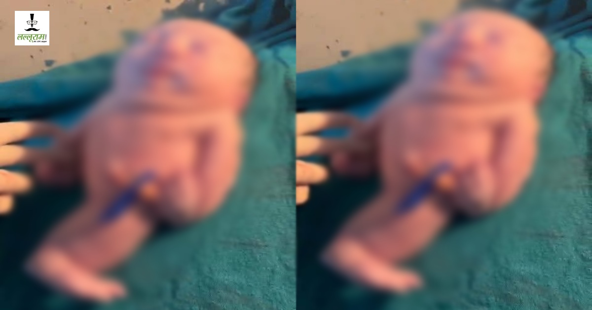 मछली के आकार का बच्चा : जन्म के बाद फटी रह गईं स्टाफ की आंखें, शरीर में पेशाब करने की जगह भी नहीं, नवजात को देखने लगी लोगों की भीड़