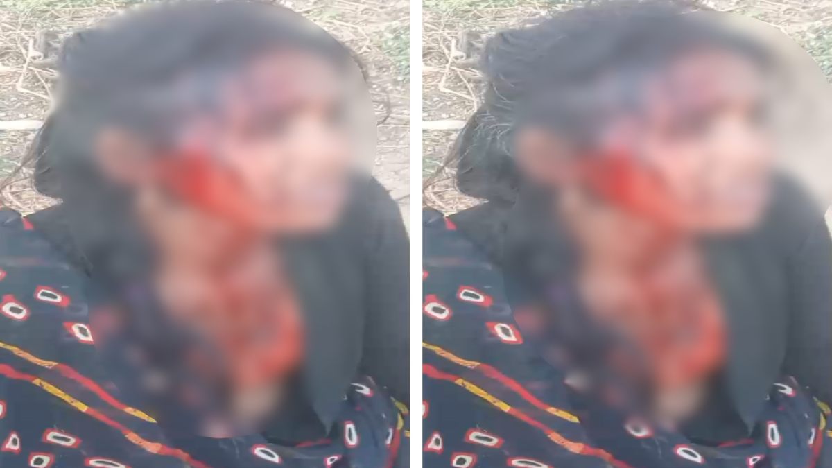 खाकी का खौफ खत्म! दबंगों ने महिला को बेरहमी से पीटा, जमकर बरसाए लाठी-डंडे, फिर…