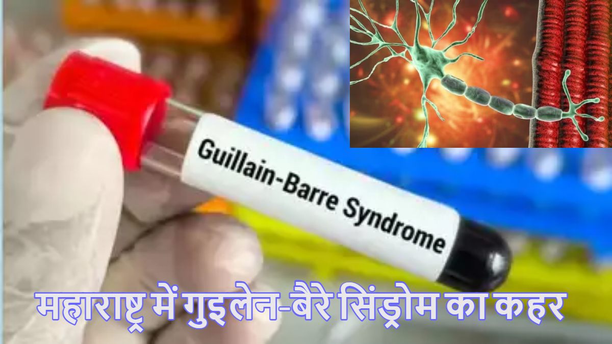 महाराष्ट्र में गुइलेन-बैरे सिंड्रोम का कहर: पुणे के बाद अब मुंबई में भी मौत, अब तक 8 की गई जान, पुणे में ही 197 मामले, 20 मरीज वेंटिलेटर पर