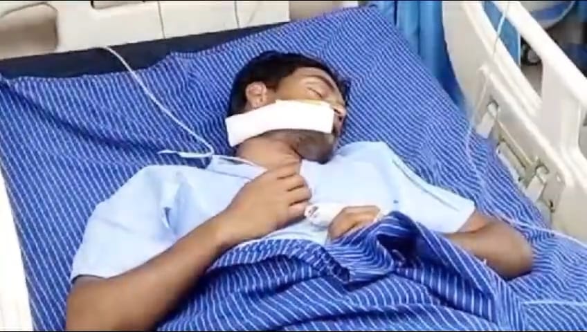 लिफ्ट न देने पर नाराज हुआ बदमाश, ऊर्जा मंत्री के भाई के होटल में चलाई गोली, जांच में जुटी पुलिस