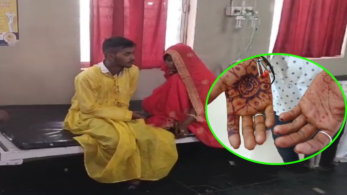 प्यार में पंगा: बेटी की लव मैरिज से नाराज पिता ने पहले दामाद को बेरहमी से पीटा, फिर ससुराल वालों पर बरसाए पत्थर