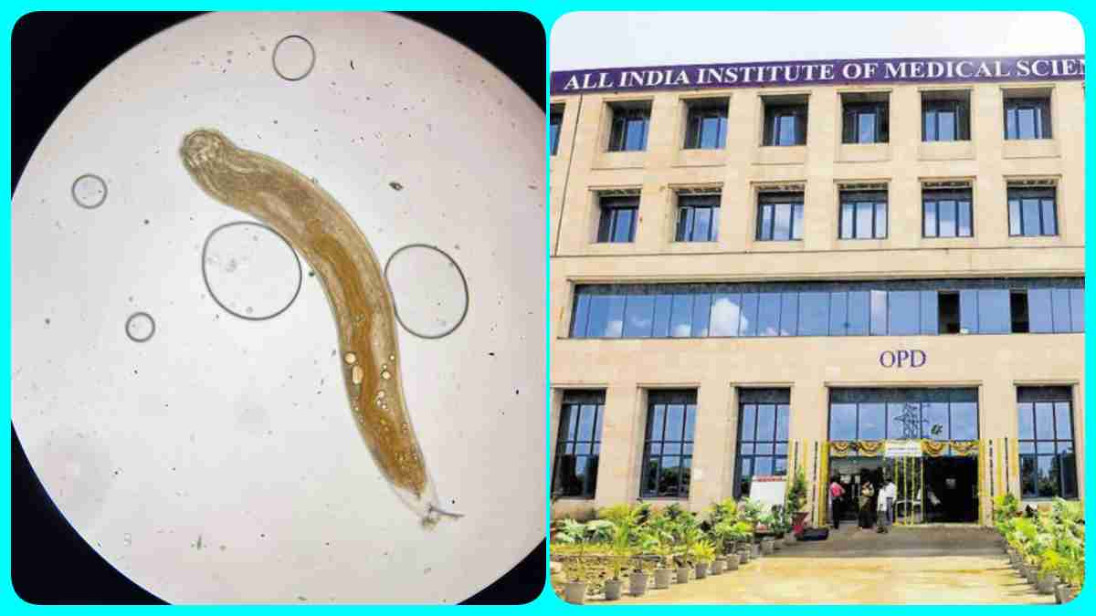 नॉनवेज के शौकीन सावधान! भोपाल AIIMS ने इस शख्स की आंख से निकाला 1 इंच लंबा कीड़ा, डॉक्टर बोले- 15 सालों के करियर में ऐसा पहला केस देखा, दुनिया का चौथा मामला