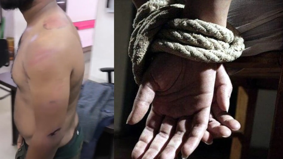 CG News: 108 एम्बुलेंस के मैनेजर की जमकर पिटाई… जख्म देख उड़ जाएंगे होश