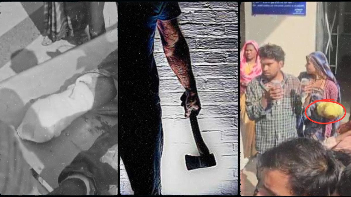 ये मजदूर है या जल्लाद! कुल्हाड़ी से काटा मालिक का पैर, हाथ में लेकर परिजन पहुंचे अस्पताल, मंजर देख सहम उठे लोग