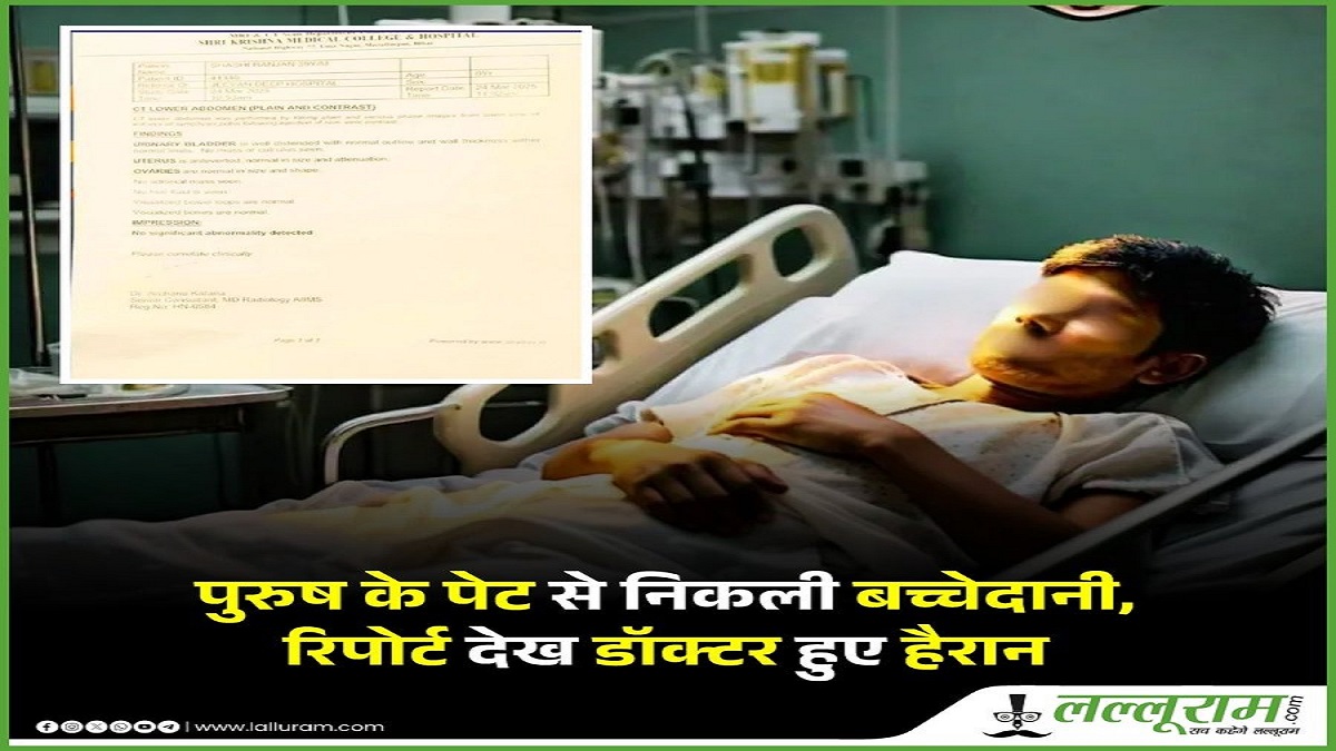 CT स्कैन कराने के बाद युवक के पेट में मिली बच्चेदानी और ओवरी, रिपोर्ट देख मरीज का चकराया सिर, डॉक्टरों के भी उड़े होश