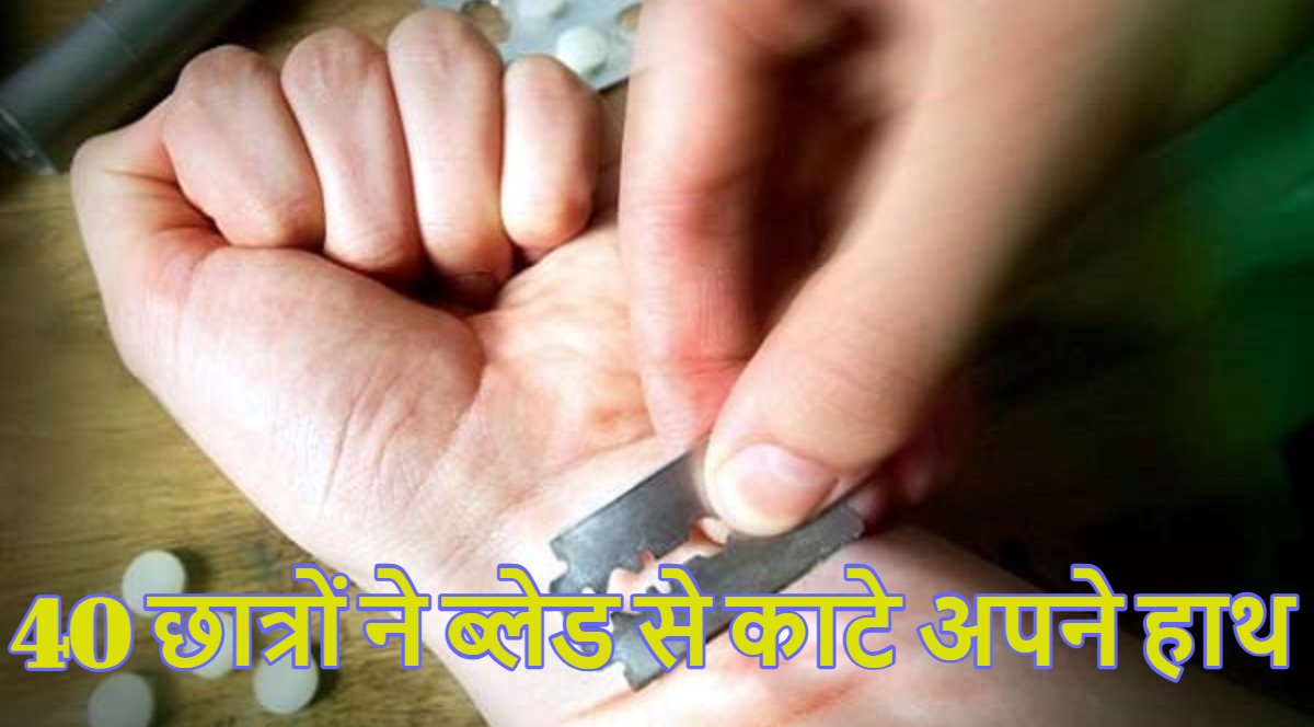40 छात्रों ने ब्लेड से काटे अपने हाथ: गुजरात के प्राइमरी स्कूल का मामला, कारण जानकर उड़ जाएंगे आपके होश