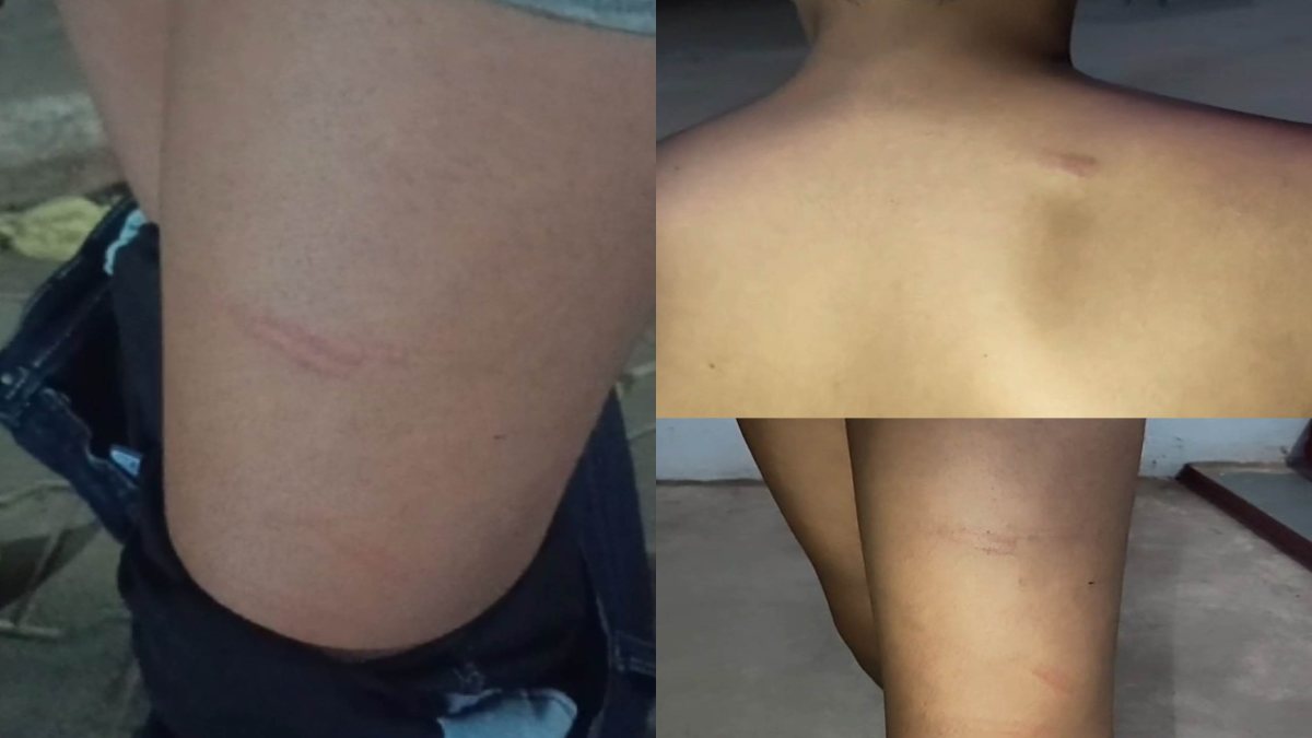 नेता जी… ऐसे सुधारेंगे समाज? भाजपा मंडल कोठी के पूर्व उपाध्यक्ष ने छात्र को डंडे से पीटा, ये है पूरा मामला