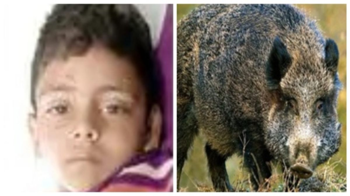 जंगली सूअर ने 4 साल के मासूम पर किया हमला: 65 टांके लगाकर डॉक्टरों ने बचाई बच्चे की जान, डेढ़ घंटे चला ऑपरेशन 