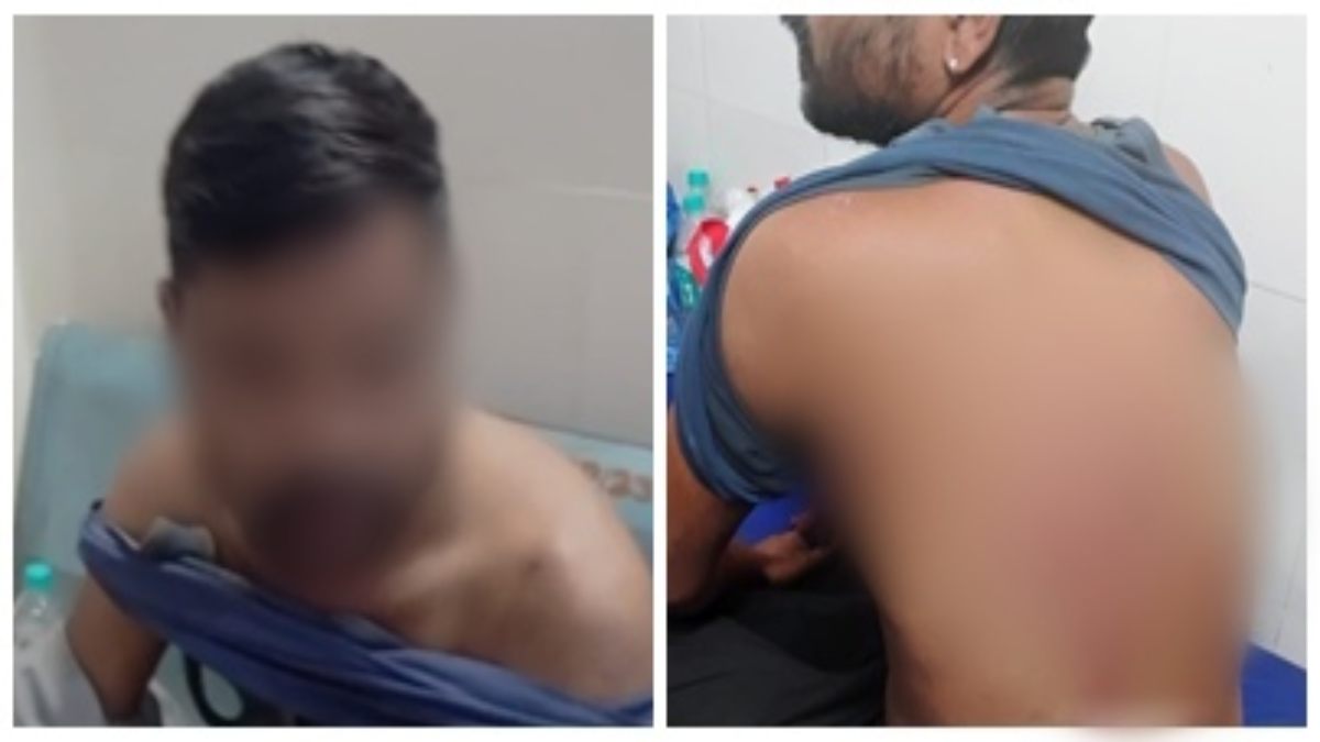 पुलिस का अमानवीय चेहरा: युवक को बेरहमी से पीटा, Video वायरल होते ही दो कांस्टेबल लाइन अटैच