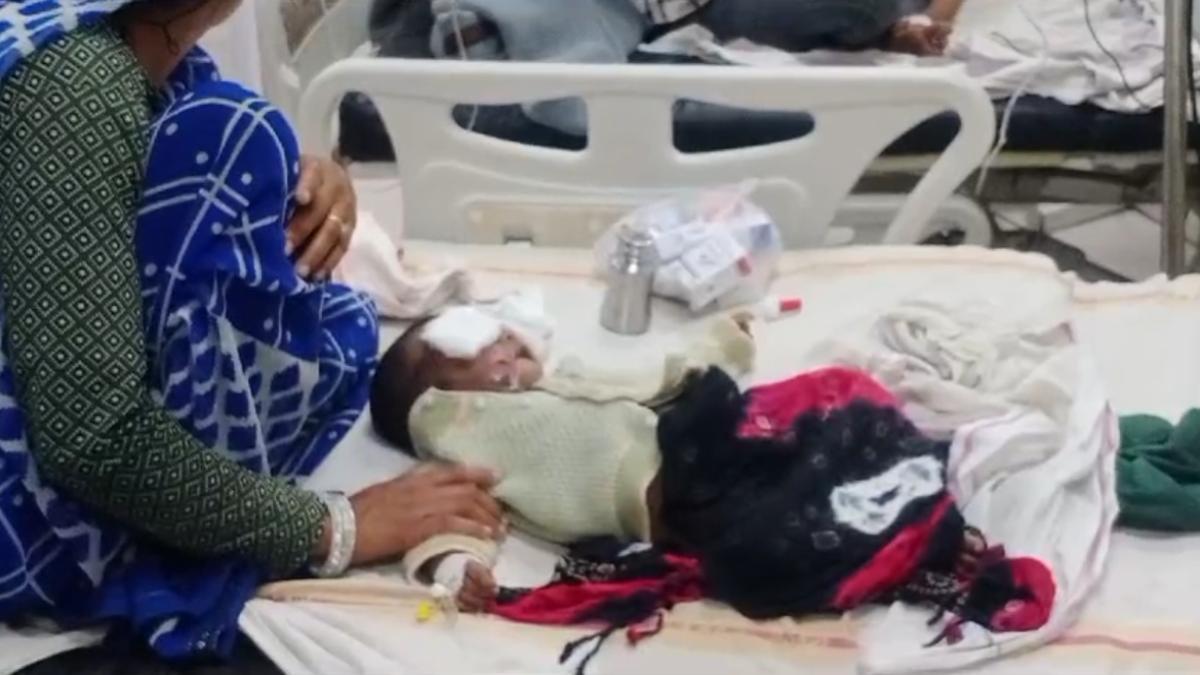 अंधविश्वास का ये कैसा खेल ? तांत्रिक ने धुनी के नाम पर 6 माह के मासूम का गाल-होंठ जलाया, दोनों आंखों पर भी हुआ असर, माता-पिता मुकरे, डॉक्टर ने की कार्रवाई की मांग
