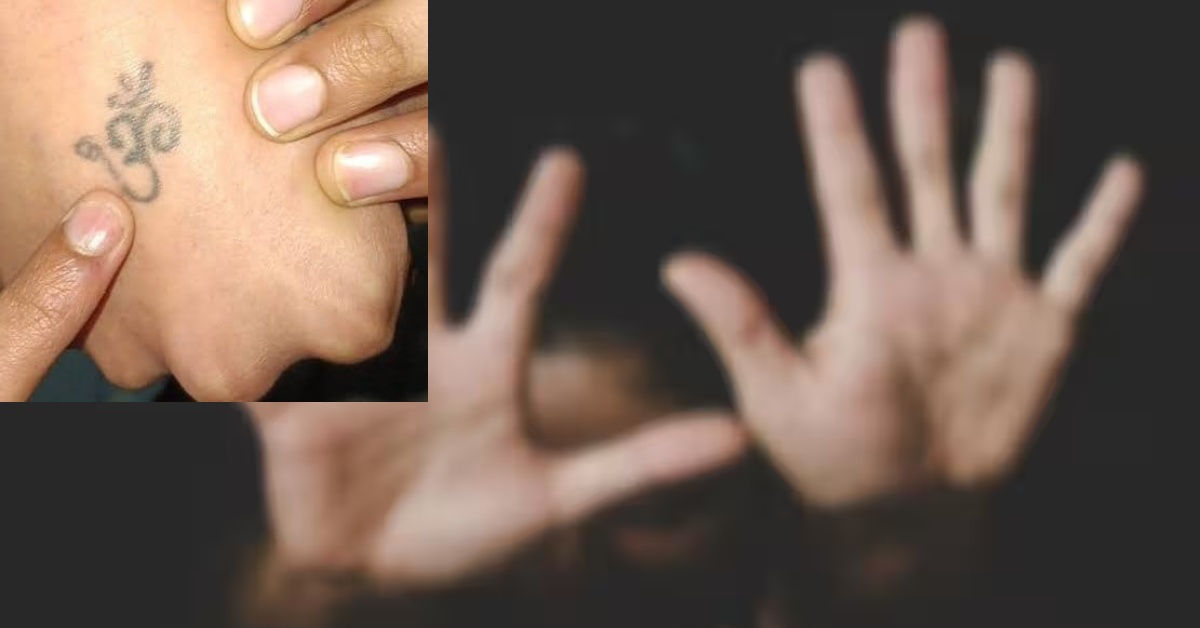 इतनी अति क्यों? दरिंदों ने हाथ में लिखे ॐ को तेजाब से मिटाया, जबरन गोमांस खिलाने का आरोप, नाबालिग का दो महीने तक किया गैंगरेप