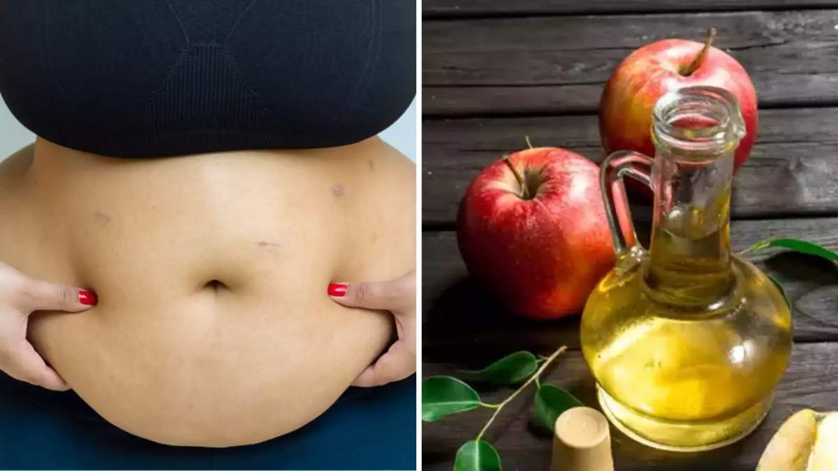 Apple Cider Vinegar for Weight Loss: क्या एप्पल साइडर सिरका सच में वजन कम करने में मदद करता है? जानें इधर…