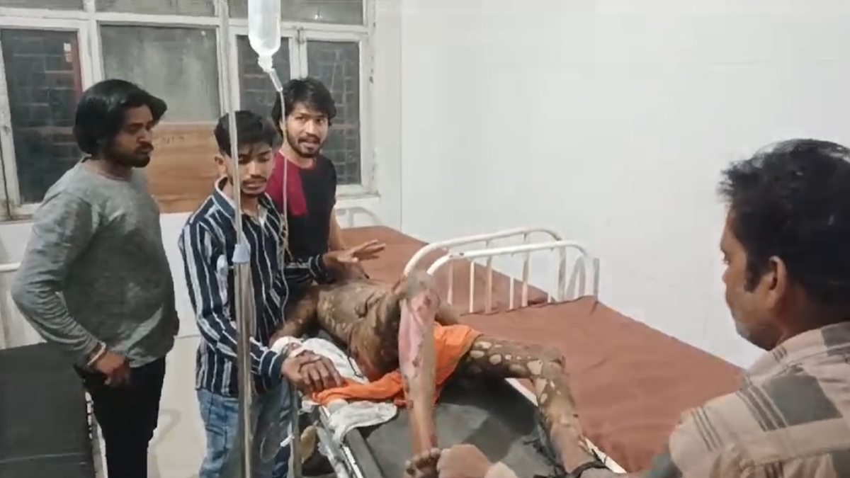 फेमस होने का पागलपनः मालगाड़ी के ऊपर खड़े होकर रील बनाना पड़ा भारी, हाईटेंशन तार की चपेट में आने से झुलसा युवक, हालत गंभीर