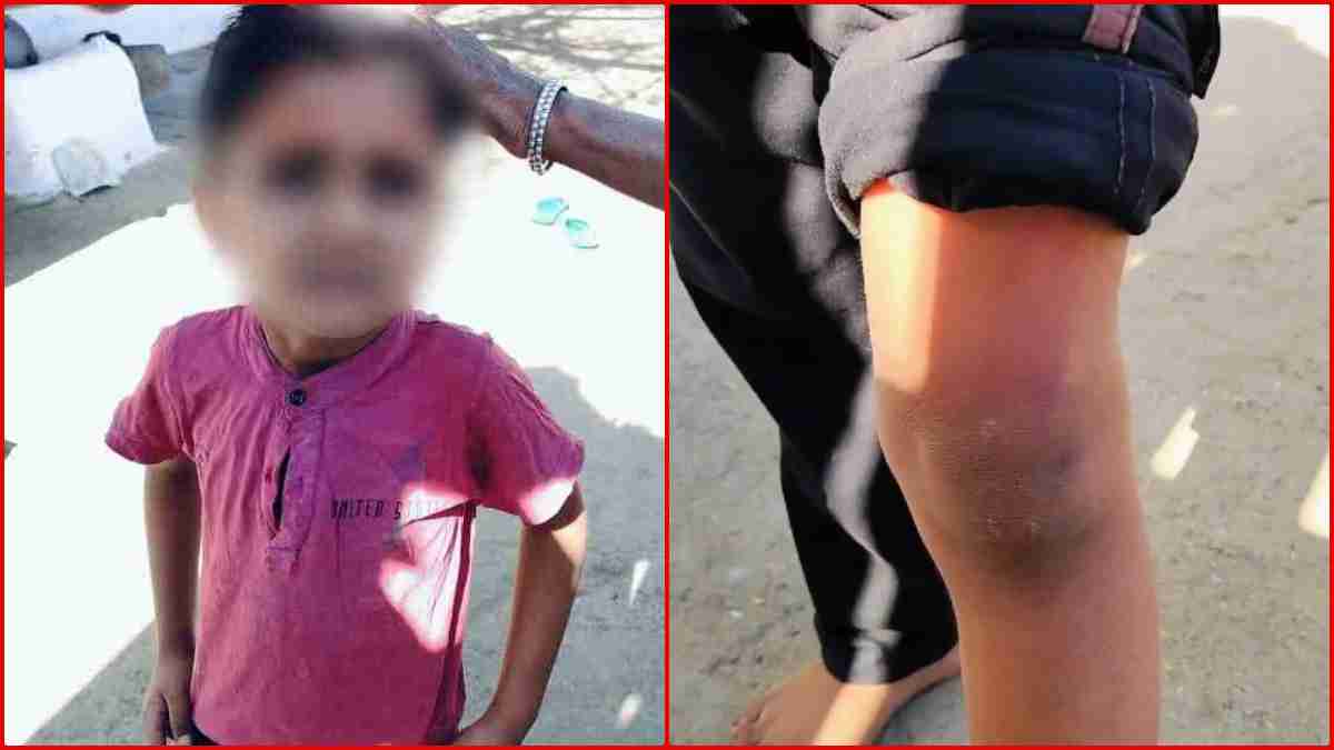बेरहम शिक्षिका! महिला टीचर पर दूसरी कक्षा के छात्र को जानवरों की तरह पीटने का आरोप, पिता ने कहा- खेत से स्कूल पहुंचा तो…