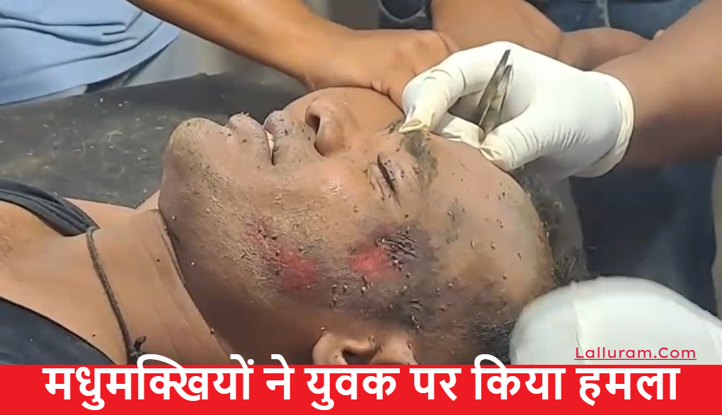 CG News: ये रोड एक्सीडेंट नहीं, युवक के चेहरे पर मधुमक्खियों के डंक है…