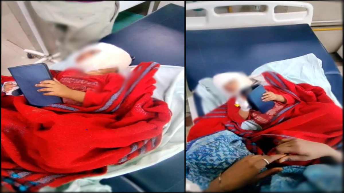पागल कुत्ते का आतंक: 3 साल की मासूम पर किया हमला, बच्ची को जबड़े में दबाया, होंठ, आंख, गाल पर आए 25 से अधिक टांके