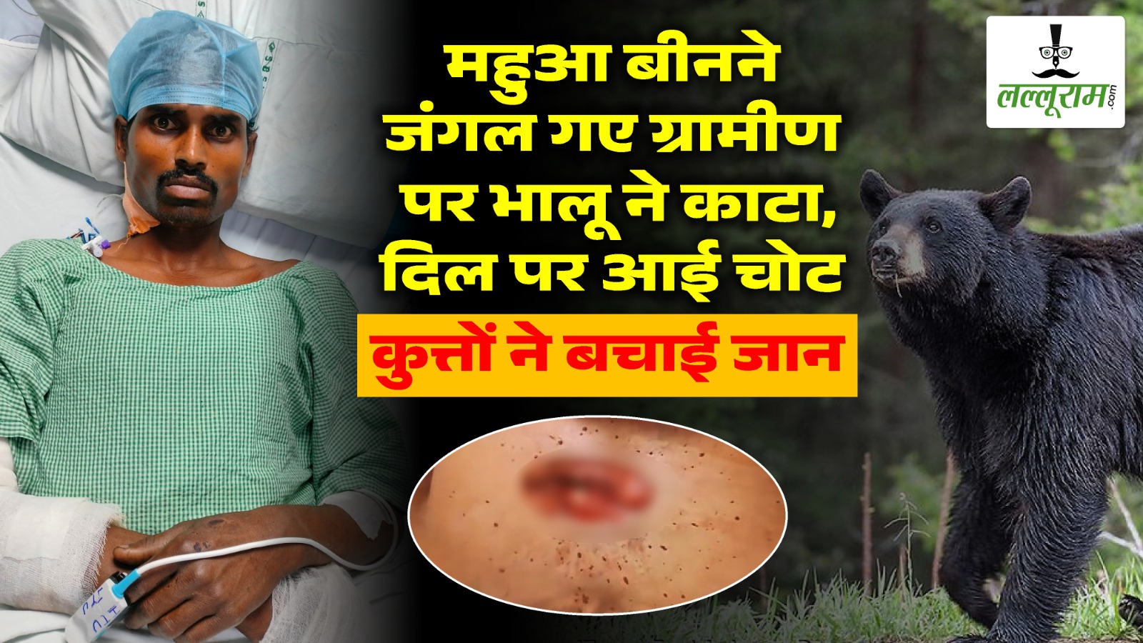 CG News: महुआ बीनने जंगल गए ग्रामीण पर भालू ने काटा, दिल पर आई चोट… जंगली कुत्तों ने बचाई जान