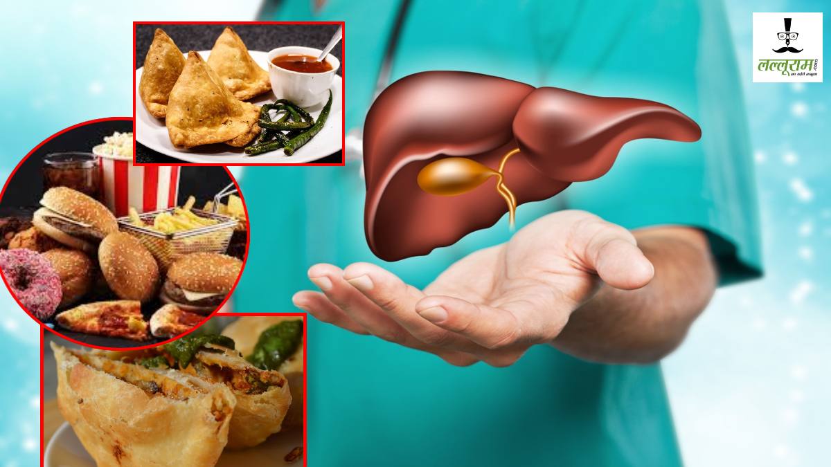 World Liver Day 2025: जंक फूड खाने वाले हो जाएं सावधान!, ‘Non-Alcoholic ‘ लोगों में बढ़ी ‘फैटी लिवर’ की समस्या, डॉक्टर ने दी ये सलाह