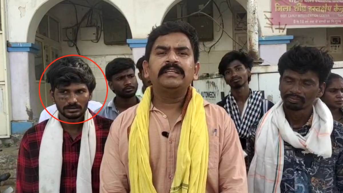 ये क्या कर दिया! चेहरे की हड्डी के इलाज के लिए आए मरीज का डॉक्टर ने सील किया मुंह, अब जयस ने दी ये चेतावनी