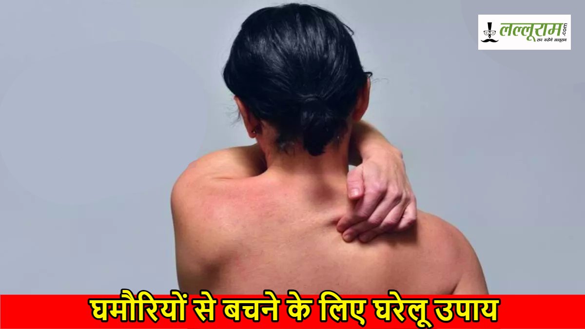 Prickly Heat Home Remedies: तेज गर्मी में घमौरियों से बचने के लिए अपनाएं ये असरदार घरेलू उपाय…