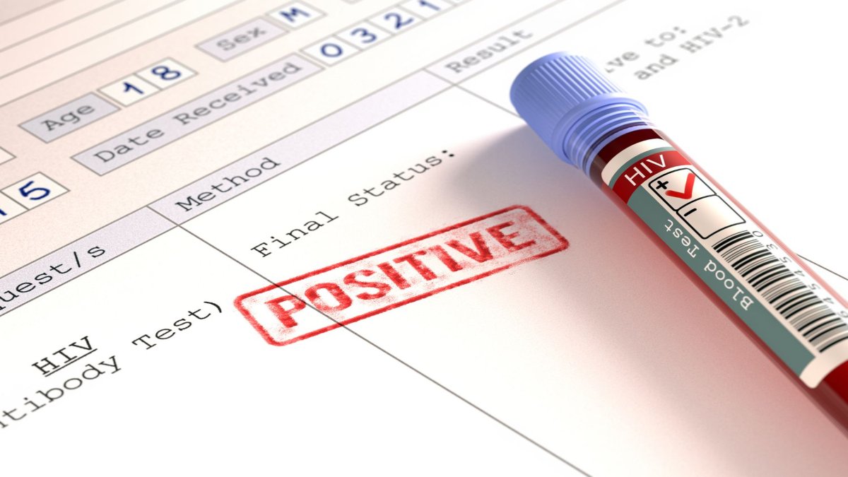ओ भाई… जिला कारागार में मिले 15 कैदी HIV पॉजिटिव, जेल प्रशासन में मचा हड़कंप