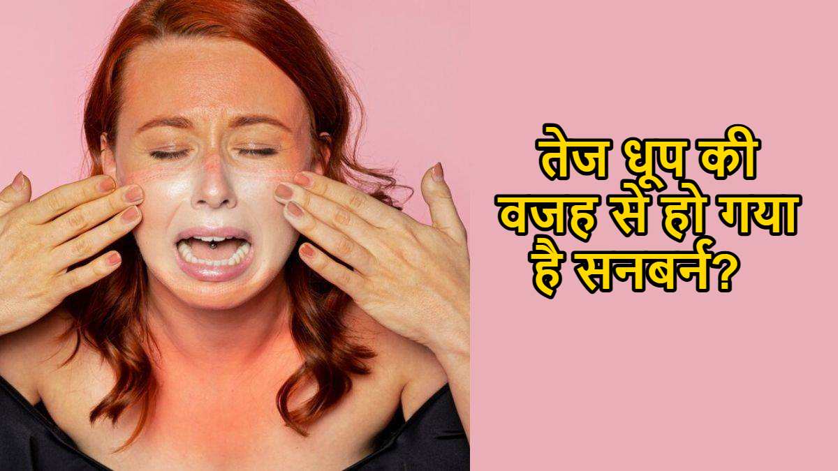Home Remedies for Sunburn: तेज धूप की वजह से हो गया है सनबर्न? तो घर में ही अपनाएं ये उपाय और पाएं राहत…