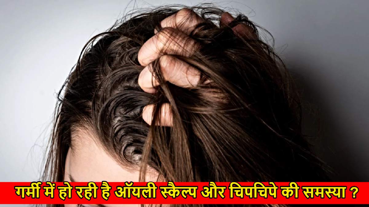Hair Care Tips For Oily Scalp: गर्मी में हो रही है ऑयली स्कैल्प और चिपचिपे की समस्या ? अपनाएं ये घरेलू नुस्खे…