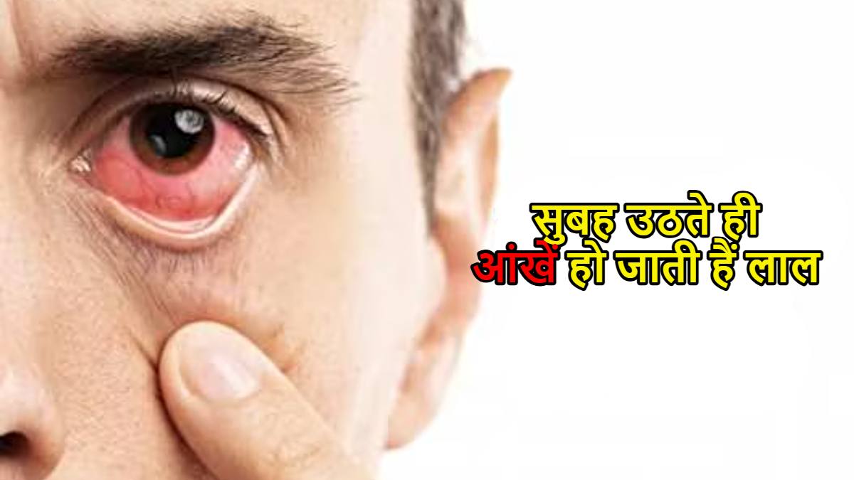 सुबह उठते ही आंखें हो जाती हैं लाल? जानिए इसके पीछे का कारण और बचाव के आसान उपाय…
