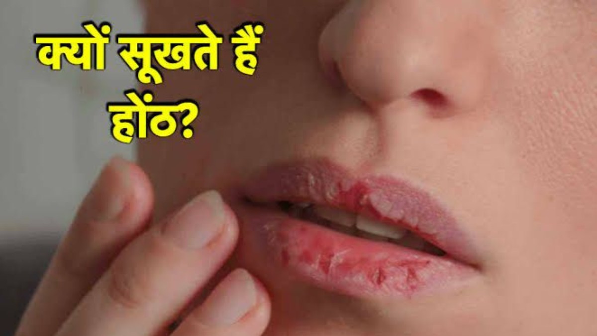 Dry Lips: इन कारणों के वजह से बार-बार सूखते हैं होंठ, इस विटामिन की हो सकती है कमी…