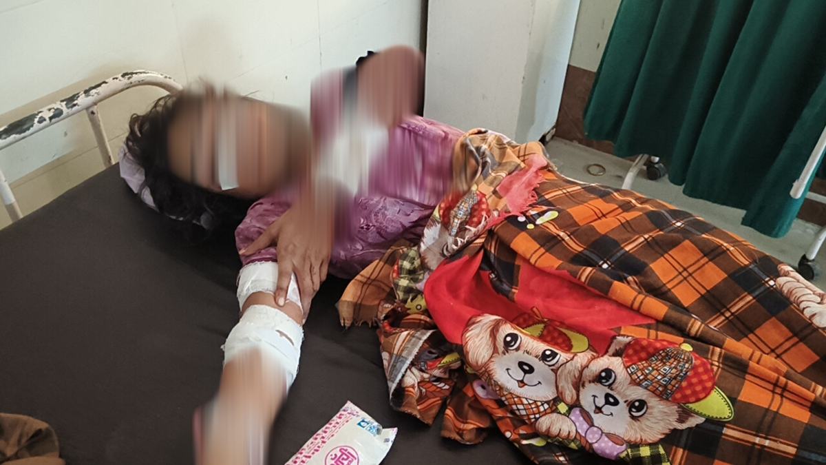 नाजायज संबंध के चलते पत्नी पर जानलेवा हमला, सनकी पति ने हंसिए से काट दिया शरीर का ये हिस्सा