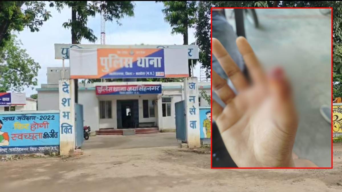 पूर्व मित्रों के बीच खूनी संघर्ष: पहले जमकर चले लात-घूंसे, फिर अंगूठा को दांत से काटकर किया अलग, इलाके में मचा हड़कंप