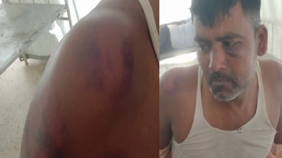 मनेर में ससुराल पहुंचा युवक छलका रहा था जाम, पुलिस ने गिरफ्तार कर बुरी तरह पिटा, हालत गंभीर होने पर अस्पताल में कराया भर्ती