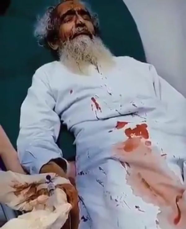BREAKING : हाफिज सईद के करीबी और लश्कर-ए-तैयबा के सह-संस्थापक पर पाकिस्तान में हमला, अज्ञात हमलावरों ने Global Terrorist Amir Hamza को मारी गोली, हालत नाजुक