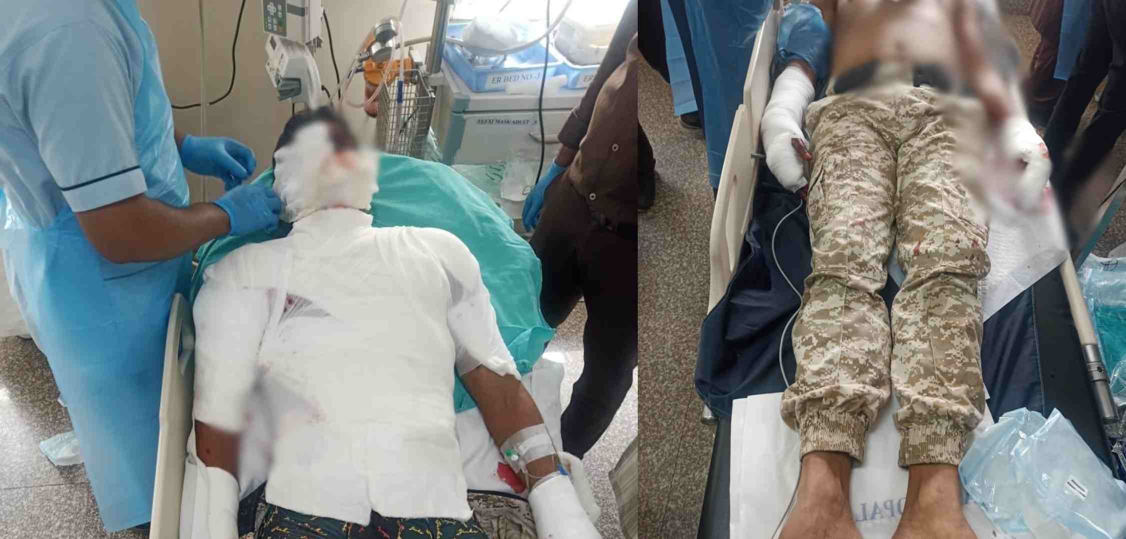 राजधानी में बड़ा हादसा: मॉकड्रिल के दौरान फटा ग्रेनेड, चपेट में आने से 2 पुलिसकर्मी गंभीर, अस्पताल में भर्ती